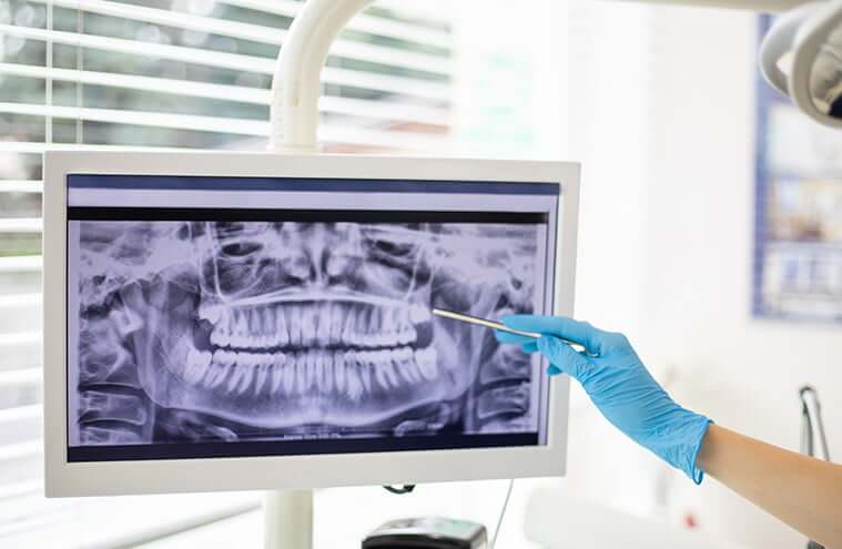 dental x-ray